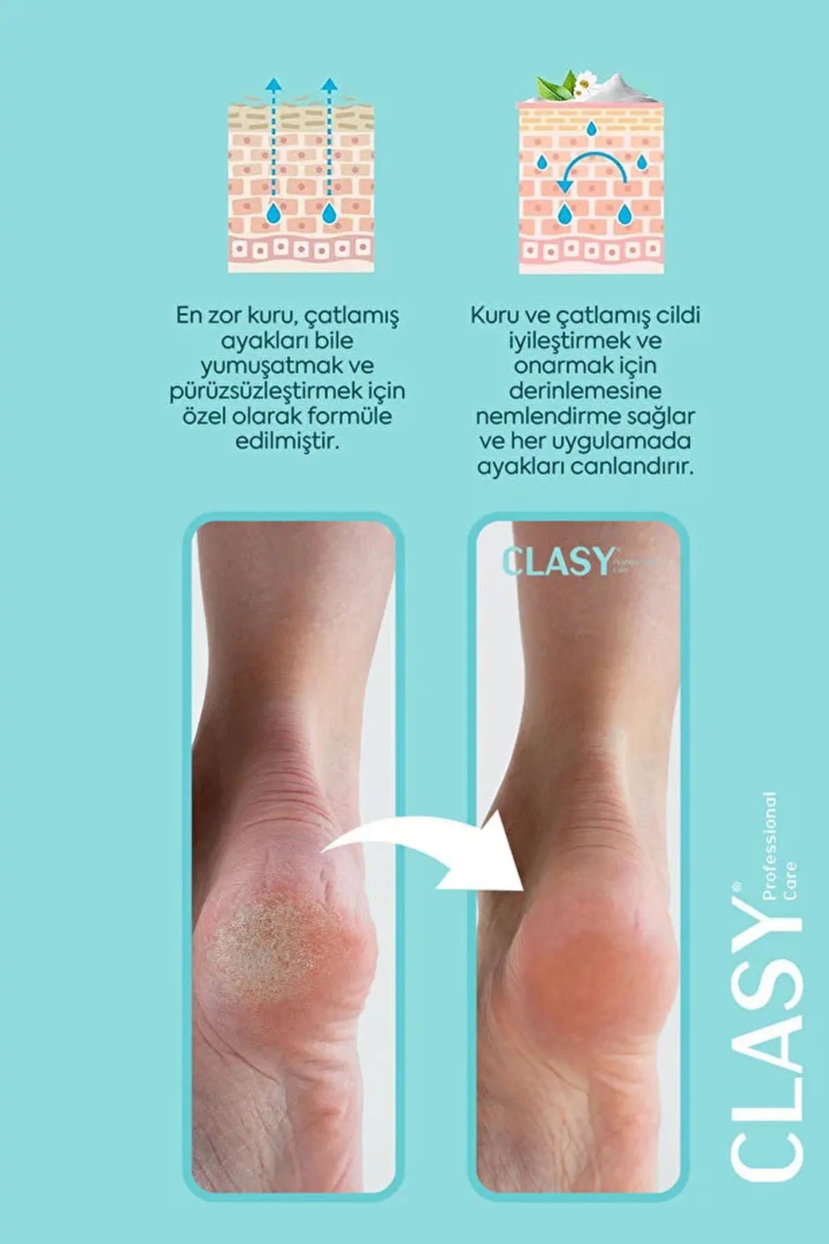 Clasy Care Ayak Ve Topuk Çatlak Kremi, Ayak Bakımı, Ayak Kokusu Ve Topuk 100ml