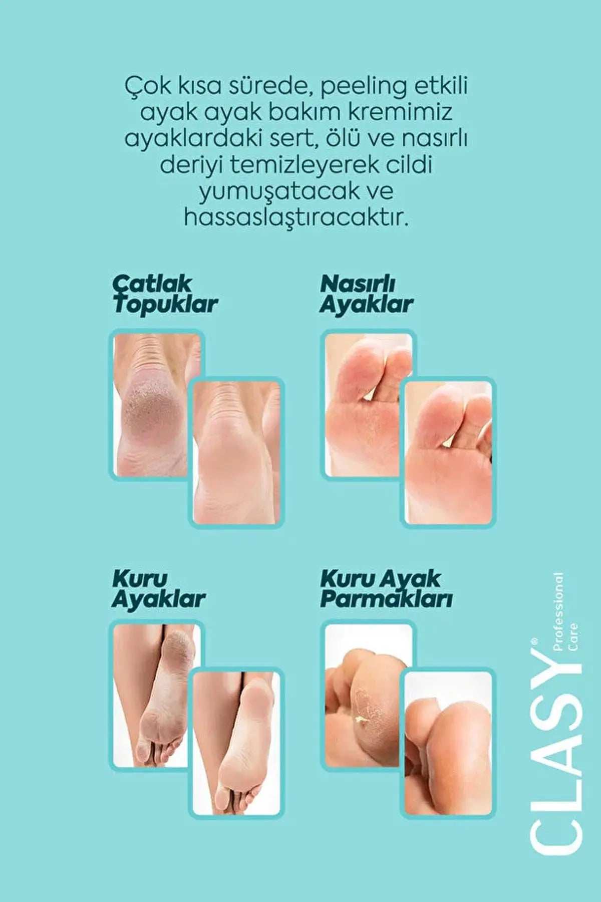 Clasy Care Ayak Ve Topuk Çatlak Kremi, Ayak Bakımı, Ayak Kokusu Ve Topuk 100ml