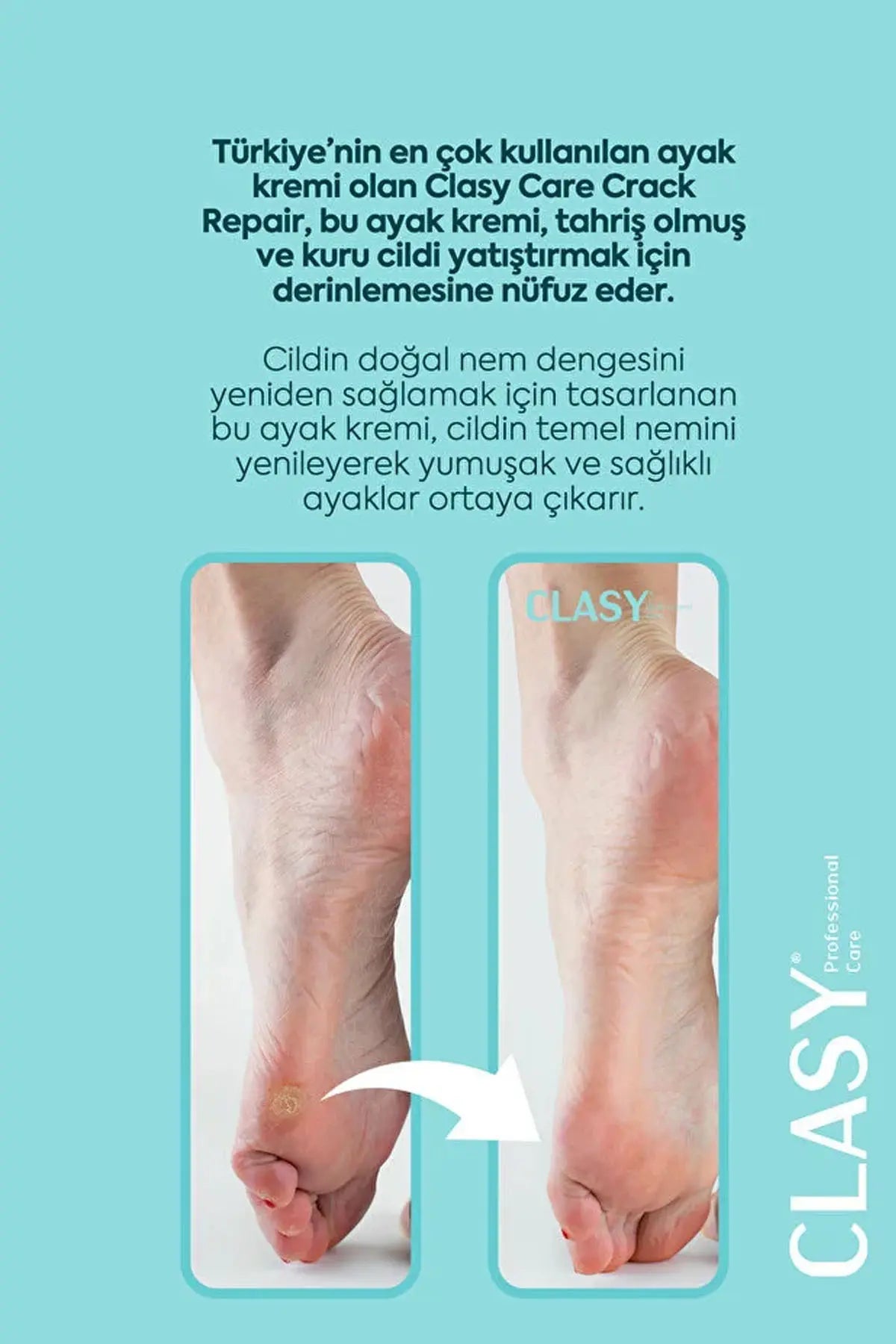 Clasy Care Ayak Ve Topuk Çatlak Kremi, Ayak Bakımı, Ayak Kokusu Ve Topuk 100ml